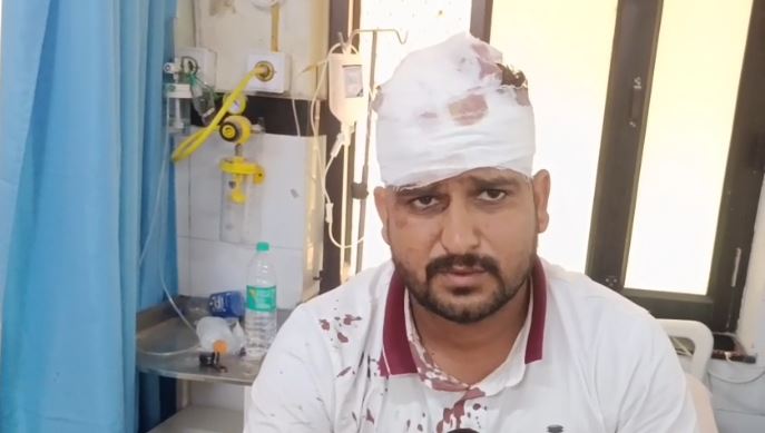 897 हमले में घायल तिजारा के पूर्व पार्षद योगेश सैनी