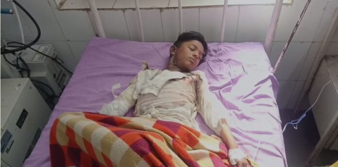 हाईटेंशन लाइन की चपेट में आया बच्चा गंभीर घायल