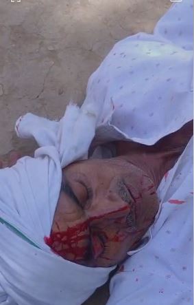 कुल्हाड़ी से हमले में घायल