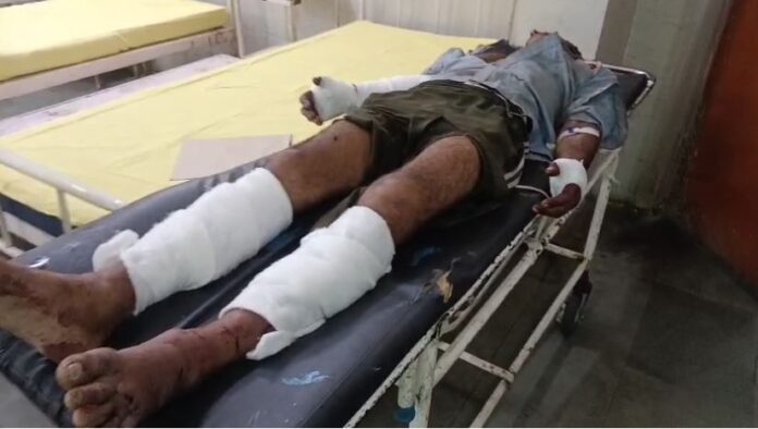 बड़े भाई पर हमला हालत गंभीर