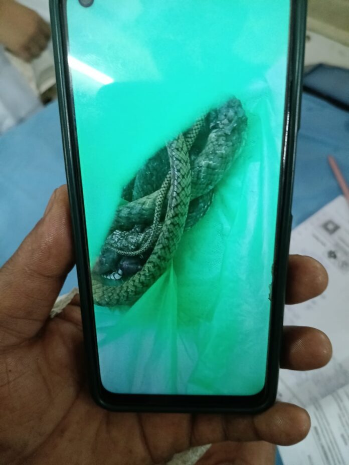 डॉक्टरों को वह सांप दिखाया जिसने उन्हें काटा था