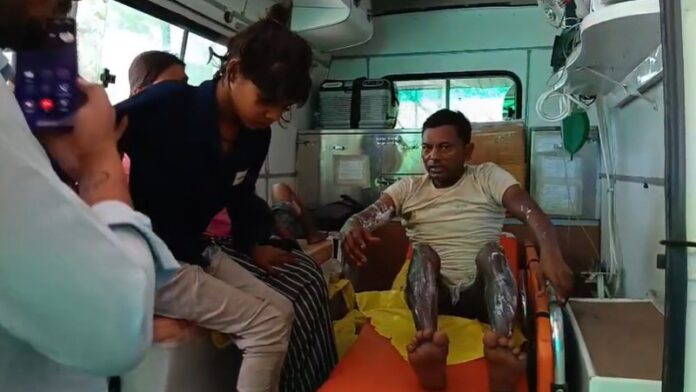 हादसे में एक परिवार के 7 लोग झुलसे