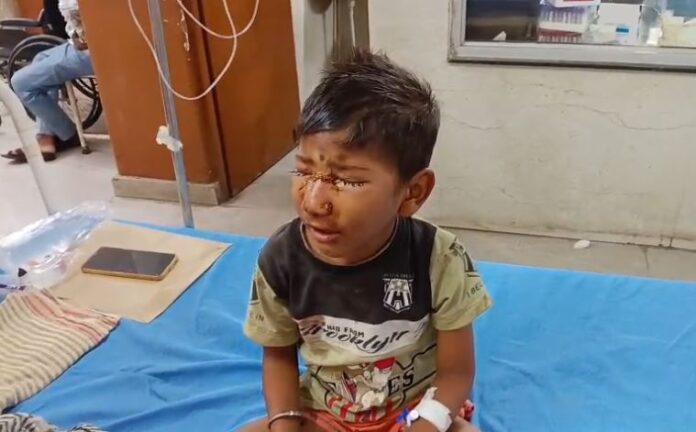 जिला अस्पताल में उपचाराधीन घायल बालक