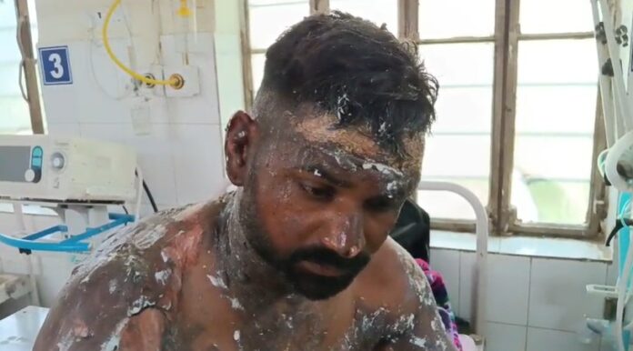 करंट लगने से श्रमिक गंभीर झुलसा