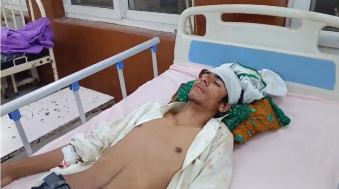 154 युवक गंभीर हालत में अलवर जिला अस्पताल में भर्ती