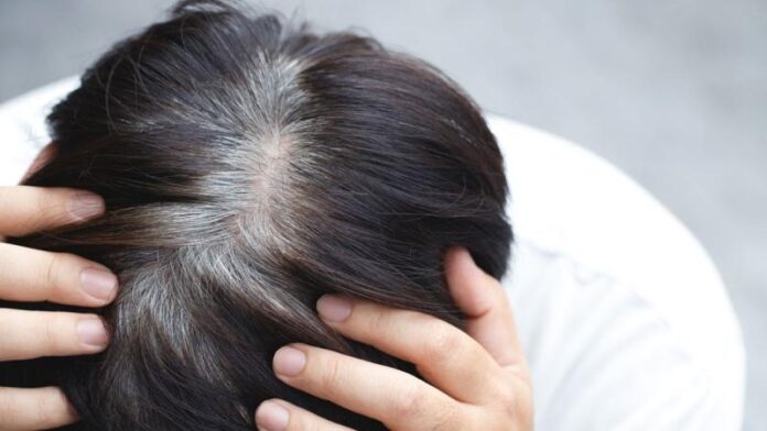 iaqld718_greying-of-hair_625x300.jpg