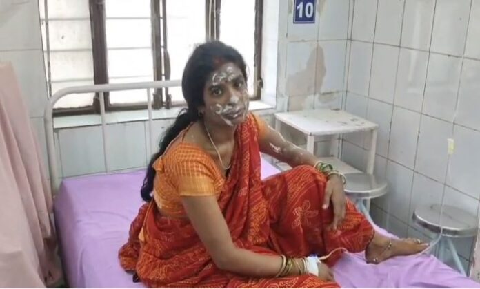 2362 चोपानकी सिलेंडर आग हादसा