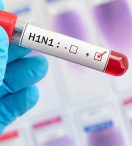 2rgoo8a8_swine-flu-h1n1-flu-viru.jpg