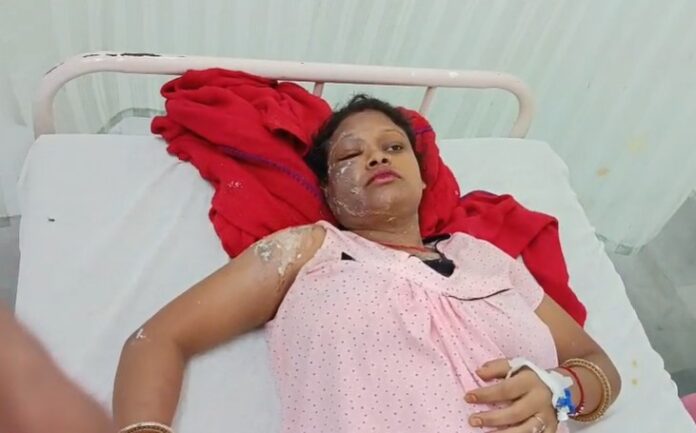 खाना बनाते समय हादसा