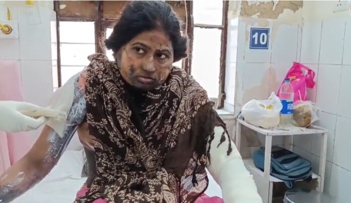 570 गैस रिसाव से आग की चपेट में आई महिला